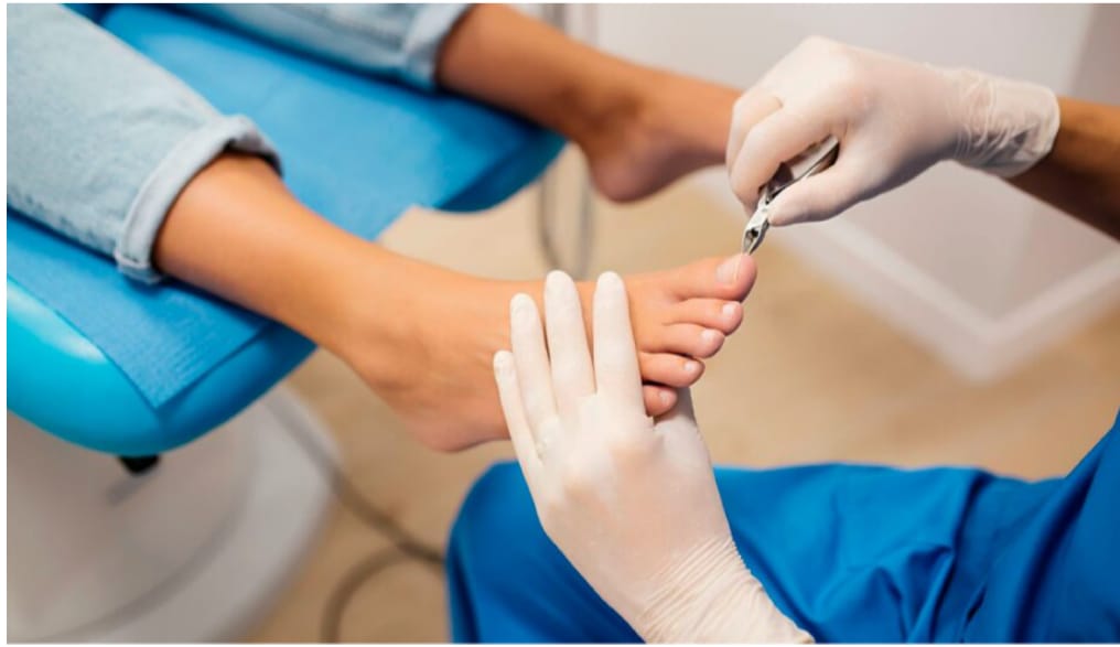 Foto de persona siendo atendida en camilla, primer plano de los pies, se enfocan las manos del profesional utilizando un alicate.